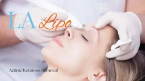 Woman receiving Actinic Keratosis Removal Treatment Wallingford