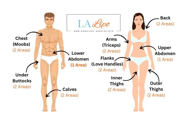 LA LIPO Cryolipolysis Areas Wallingford