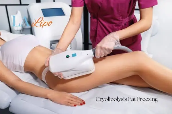 Woman receiving coolsculpting Wallingford treatment on her thighs