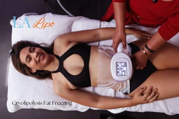 woman getting cryolipolysis Wallingford