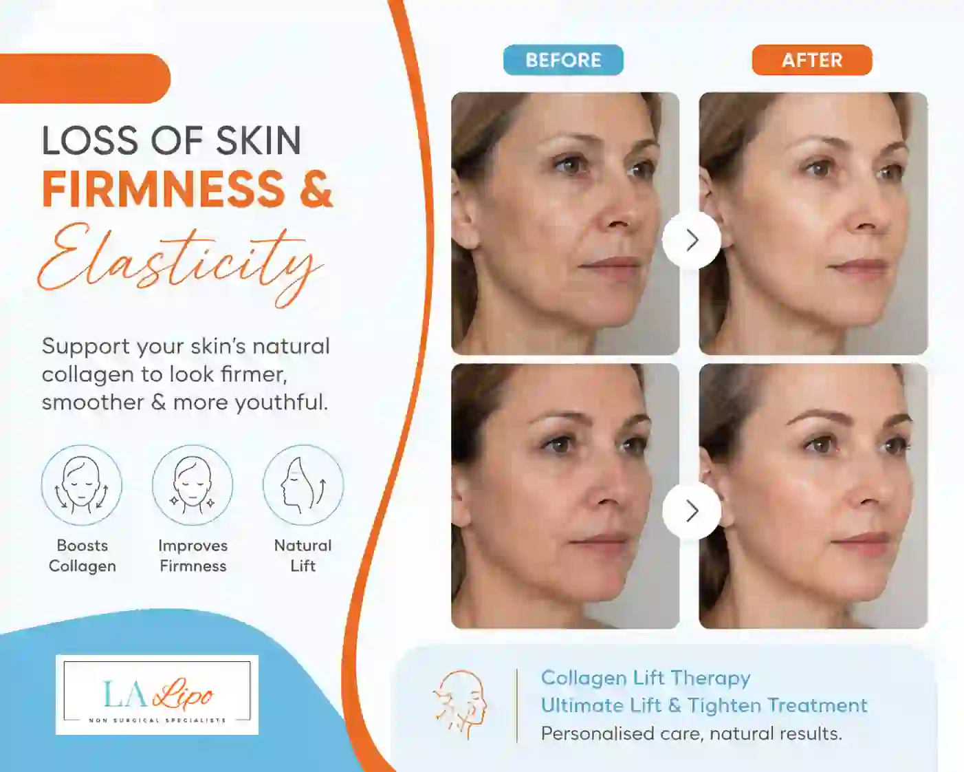 Sign #7: Loss of Skin Firmness and Elasticity Wallingford